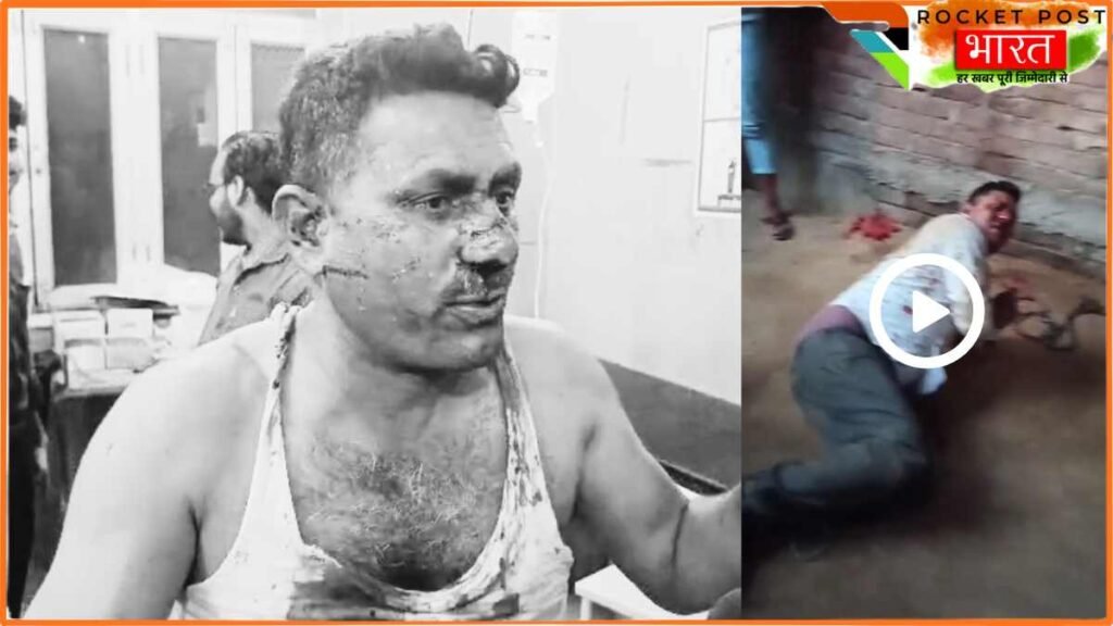 Mainpuri Viral Video: रिटायर्ड फौजी को हाथ-पैर बांधकर बेरहमी से पीटा, नाक तक काट दी.. वजह होश उड़ा देगी!