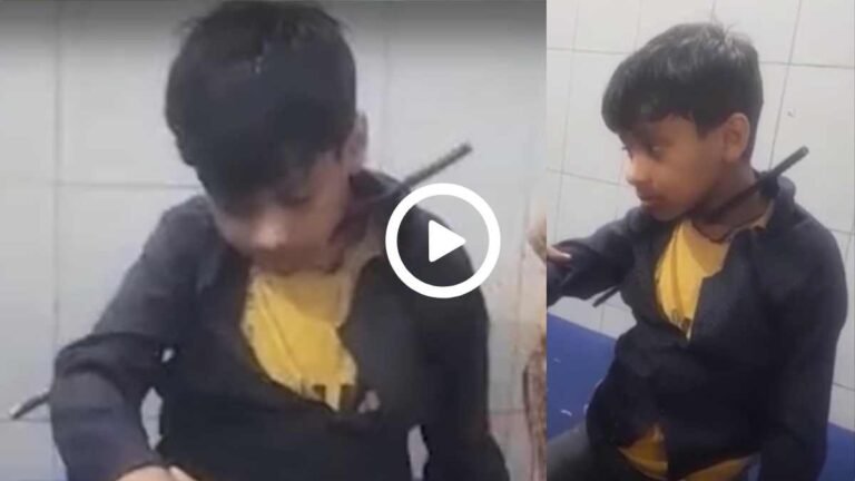 दिल दहलाने वाला Video: बच्चे के सीने से घुसा, गले से निकला लोहे का सरिया! अस्पताल लेकर दौड़ी माँ, फिर..