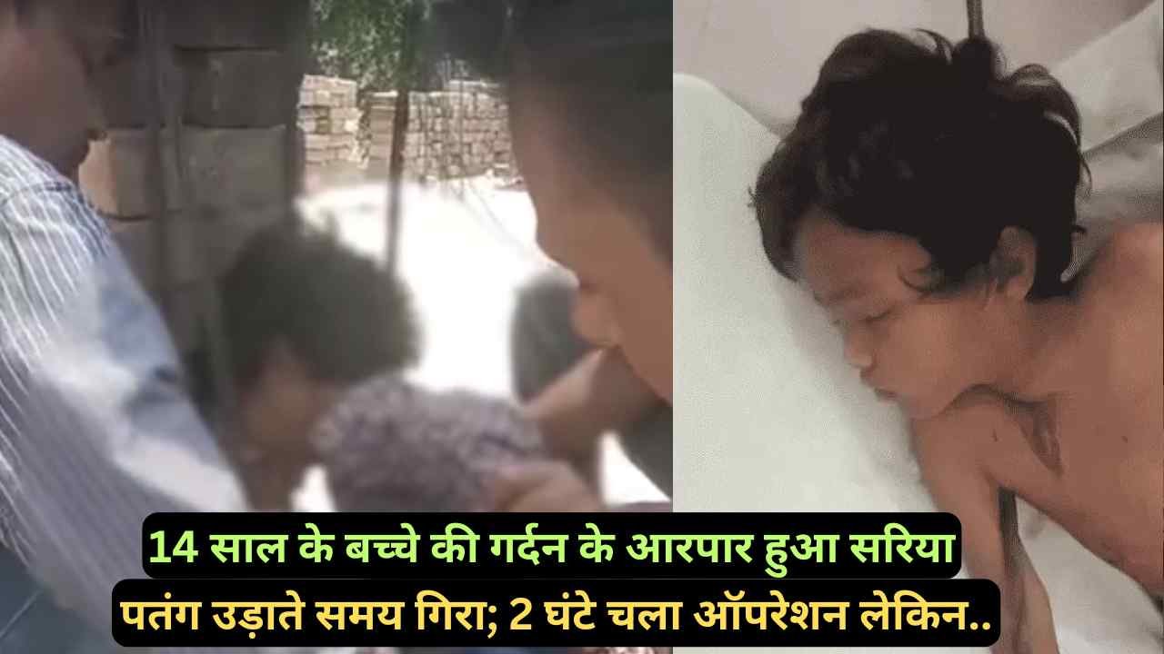 UP News: 14 साल के बच्चे की गर्दन के आरपार हुआ सरिया, पतंग उड़ाते समय गिरा; परिजनों की होशियारी से बची जान..