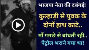UP News: भाजपा नेता की दबंगई! कुल्हाड़ी से युवक के दोनों हाथ काटे, माँ गमछे से बांधती रही.. पेट्रोल भराने गया था!