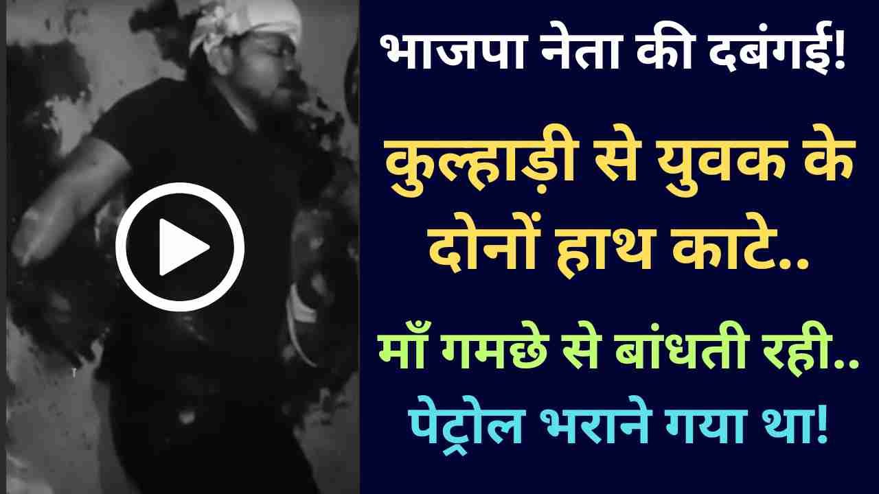 UP News: भाजपा नेता की दबंगई! कुल्हाड़ी से युवक के दोनों हाथ काटे, माँ गमछे से बांधती रही.. पेट्रोल भराने गया था!