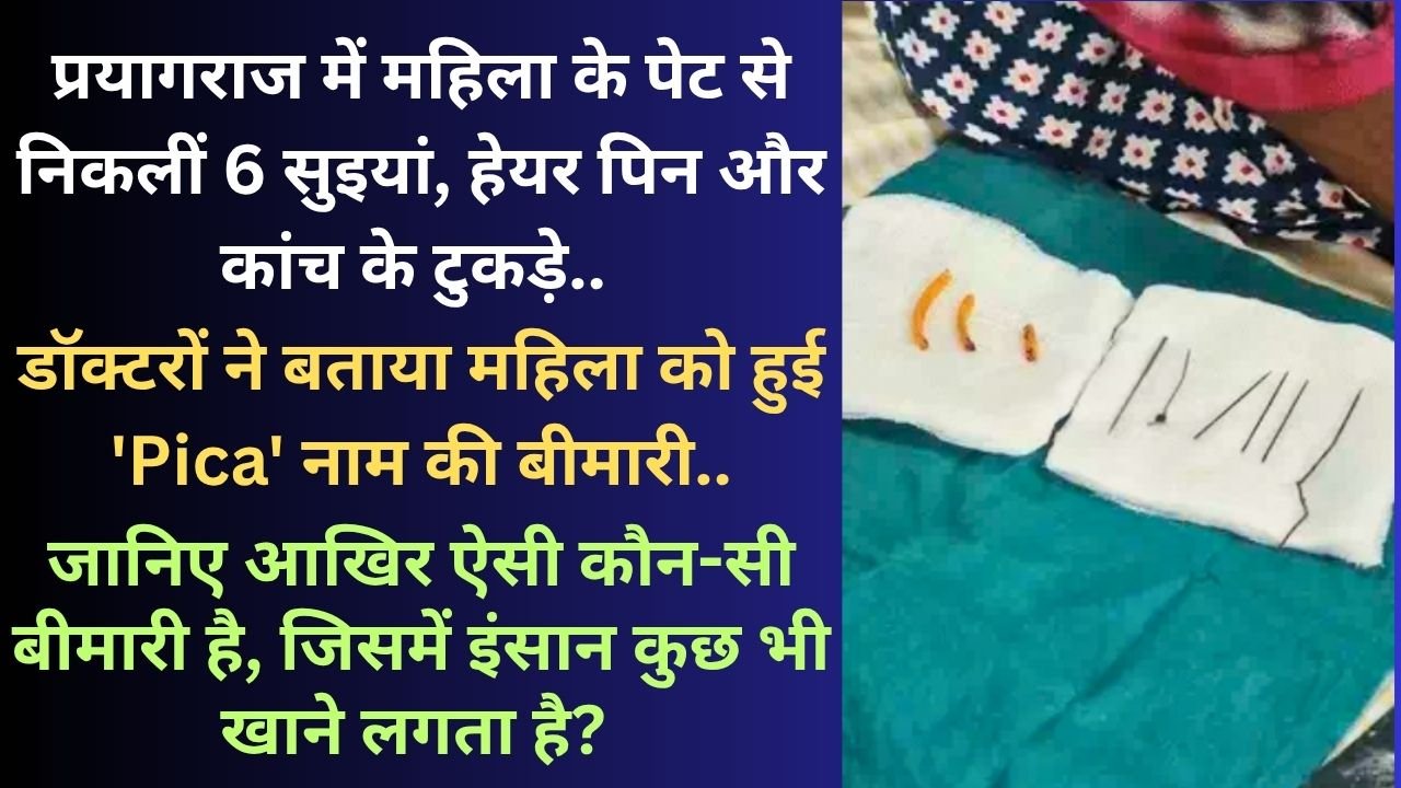 UP News: महिला के पेट से निकलीं 6 सुइयां, हेयर पिन और कांच के टुकड़े, 'Pica' नाम की बीमारी में खाने का होता है मन?